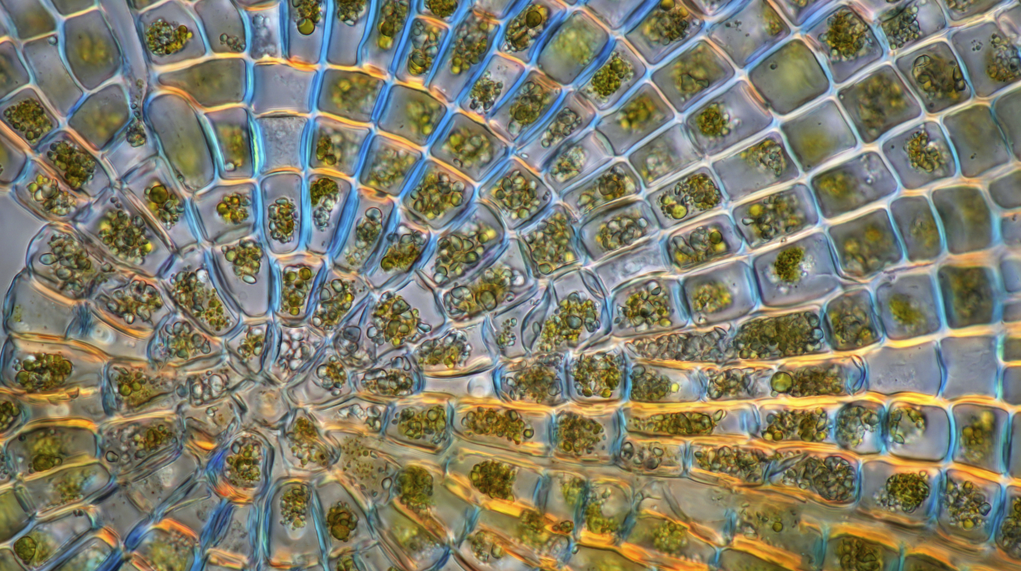Polarised light micrograph of a Coleochaete sp. green algae colony. Coleochaete algae forms flat, sprawling discs on solid surfaces such as plants or debris in freshwater streams.
