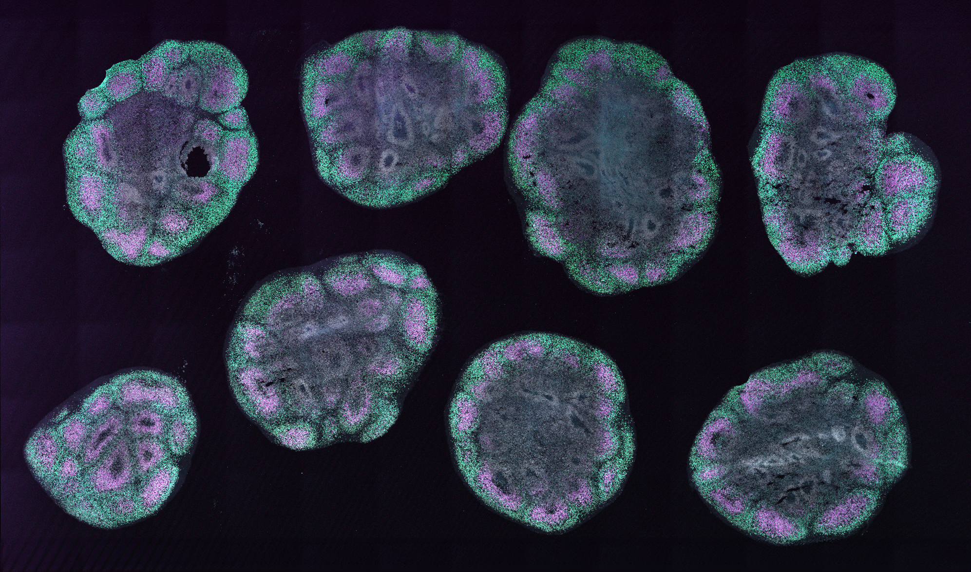 An organoid.
