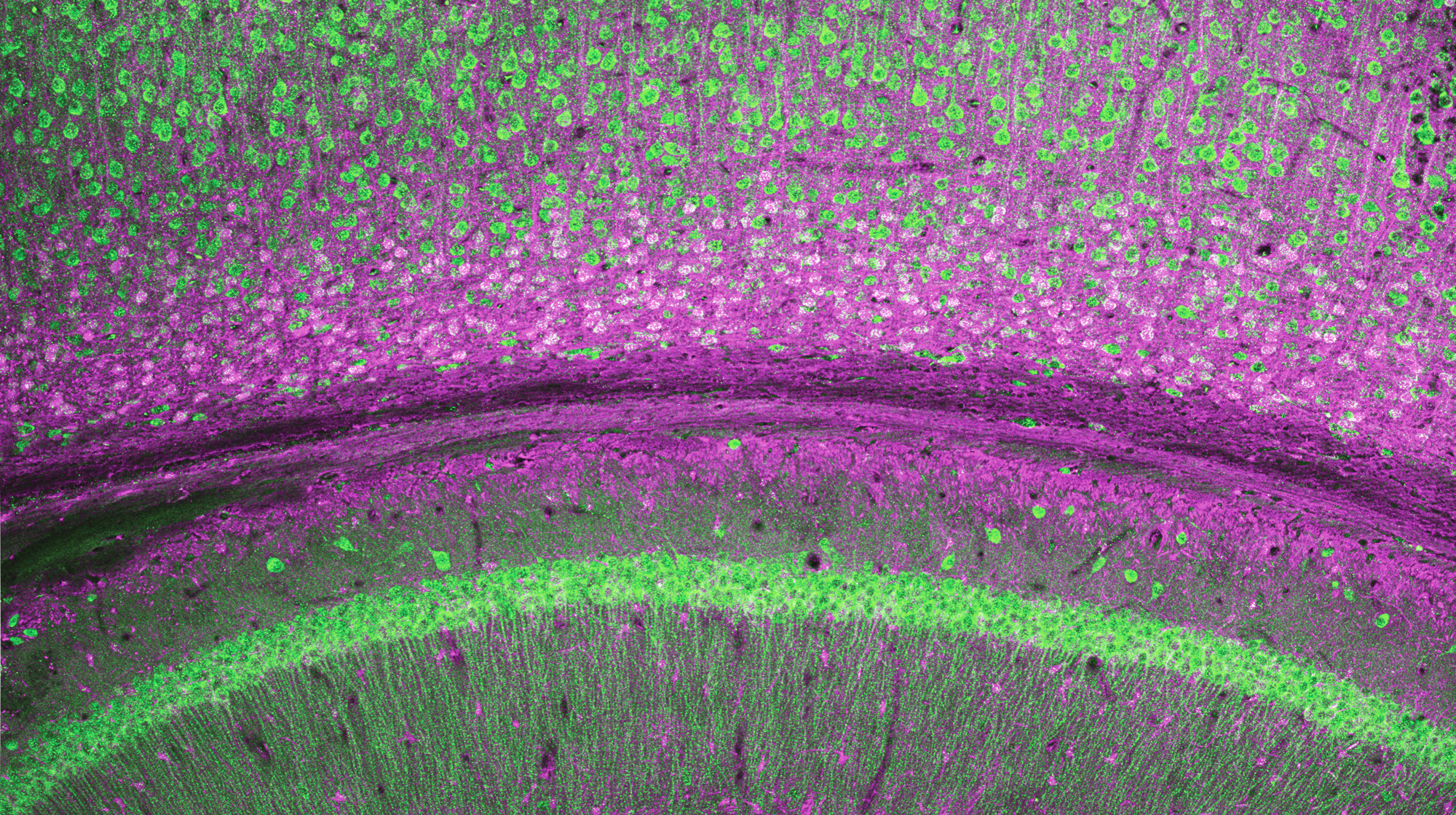 A colorful image of brain cells.