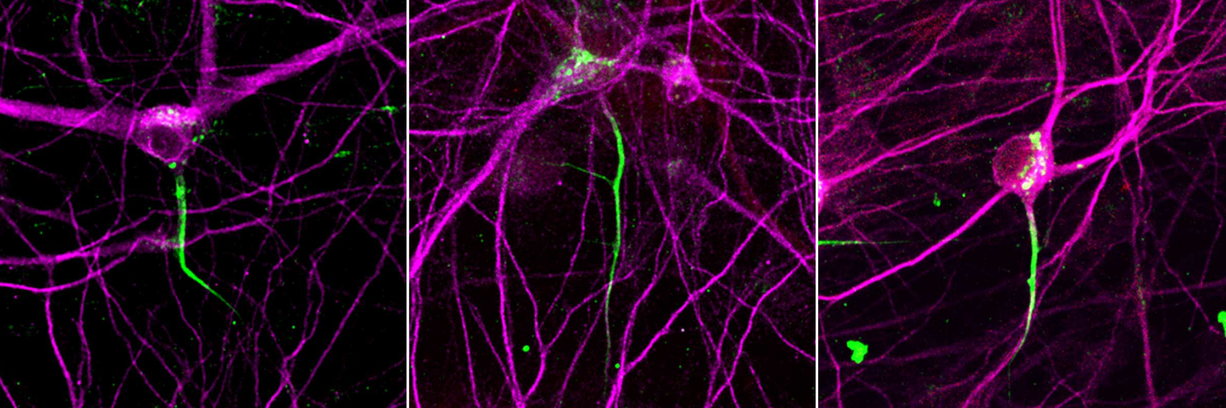 Neural cells.
