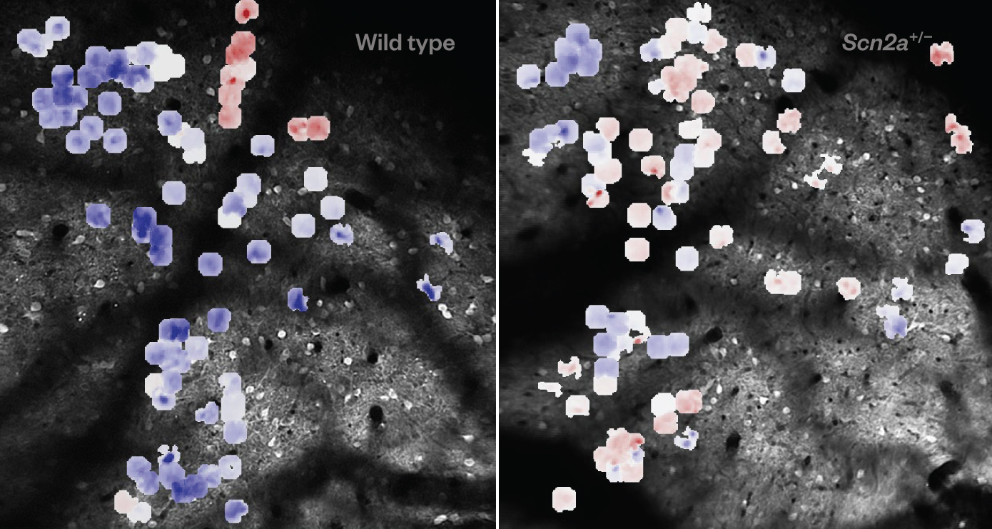 Image of the mouse superior colliculus neurons, overlaid with a color map showing the degree of plastic changes in their visual response dynamics during visual implicit learning task.