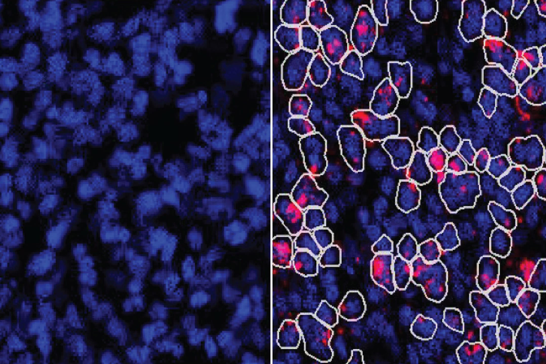 An image comparing the presence of ZBTB18 mRNA and ZBTB18 protein in germinal-zone cells shows that whilst RNA is detectable, the protein is not.