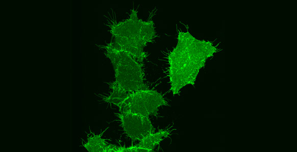 A HeLa cell expressing CD95 fused to a fluorescent protein