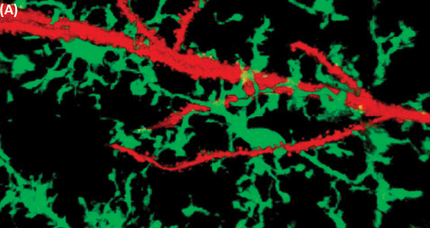 Image of microglia