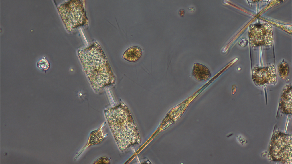 Dinoflagellates a form of marine plankton, coexist with chains of diatoms, glass-shelled organisms that Dutkiewicz calls “the most charismatic” of the marine microbes.