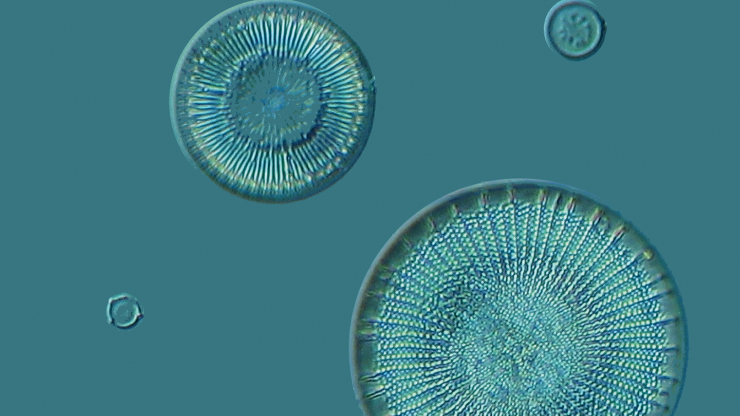 Pillbox-shaped diatoms.