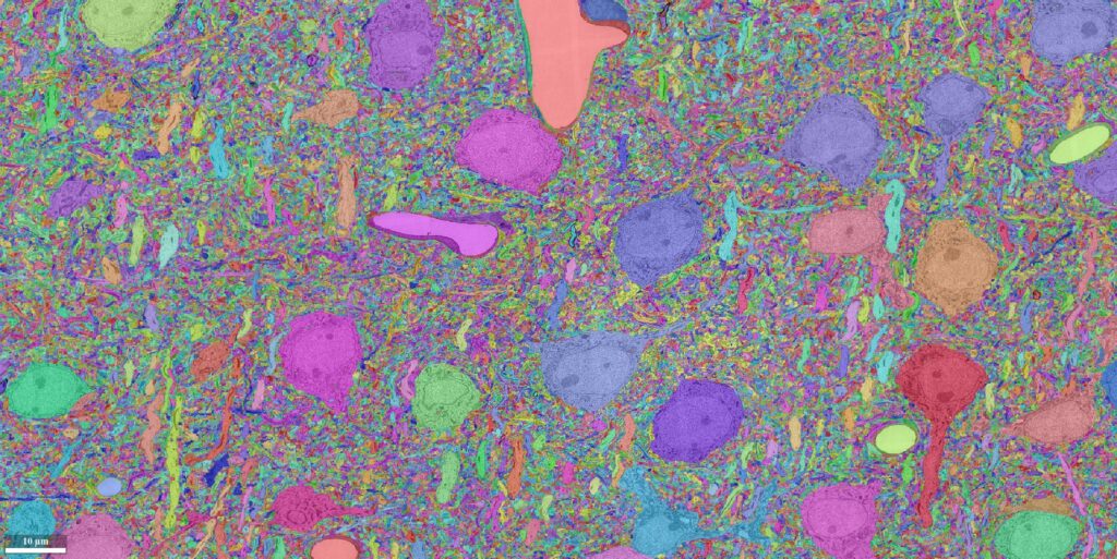 In this slice of brain tissue from the MICrONS reconstructed dataset, each neuron is assigned a unique color. The final three-dimensional reconstruction is made up of 1,000 two-dimensional slices like this one