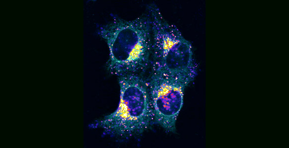 HeLa cells with a dotted pattern that shows the fluorescently tagged ligand for the receptor CD95, the molecule CD95L, which triggers apoptosis in target cells