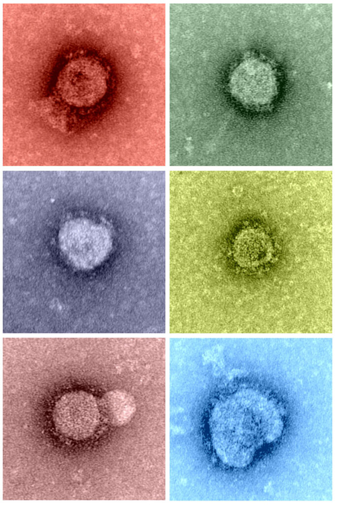 6 grainy photos of coronavirus samples as viewed under a microscope arranged in two columns. The coronavirus cells vary in shape and size, and the photos themselves are tinted different colors. The top-left photo is tinted red and shows a virus circular in shape. The top-right photo is tinted a light-blue-green and shows another circular virus cell. The middle-left photo is tinted a light grayish blue and shows a circular virus with a small dent on its upper-right side. The middle-right photo is tinted yellow and shows a circular virus smaller than the previous three samples. The bottom-left photo is tinted a light-grayish-red and shows a circular virus slightly larger than the previous photo. Finally, the bottom-right photo is tinted a light blue and shows a larger virus with a faint seam beginning from its upper left side and ending at its lower right side. The cell bends inwards at the end points of this seam, as though the photo of this sample caught the virus in the middle of mitosis.