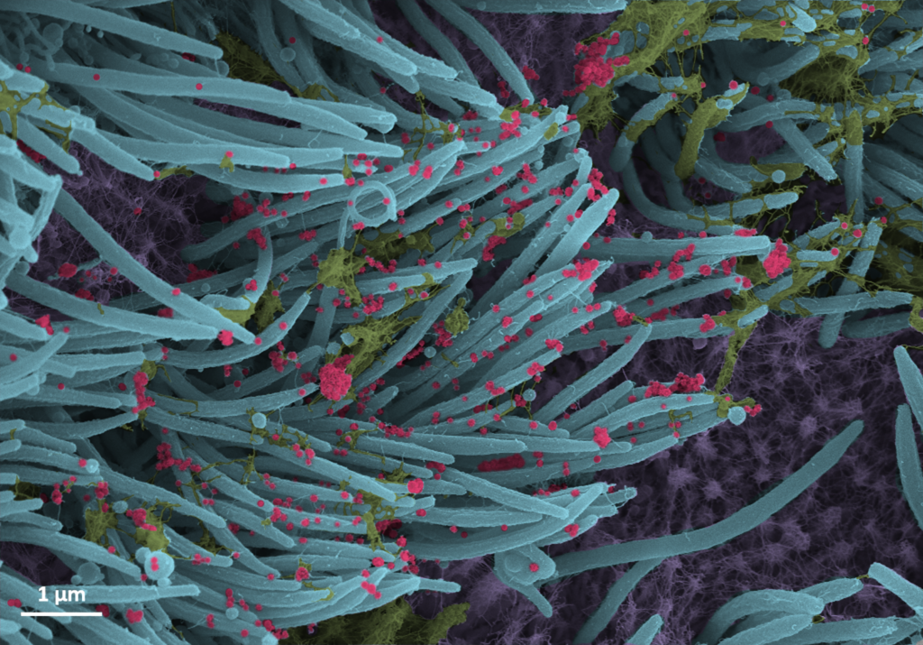 Colored electron microscope image showing blue-gray cilia with scattered pink viral particles and patches of green mucus. Scale bar at bottom left indicates 1 micrometer.