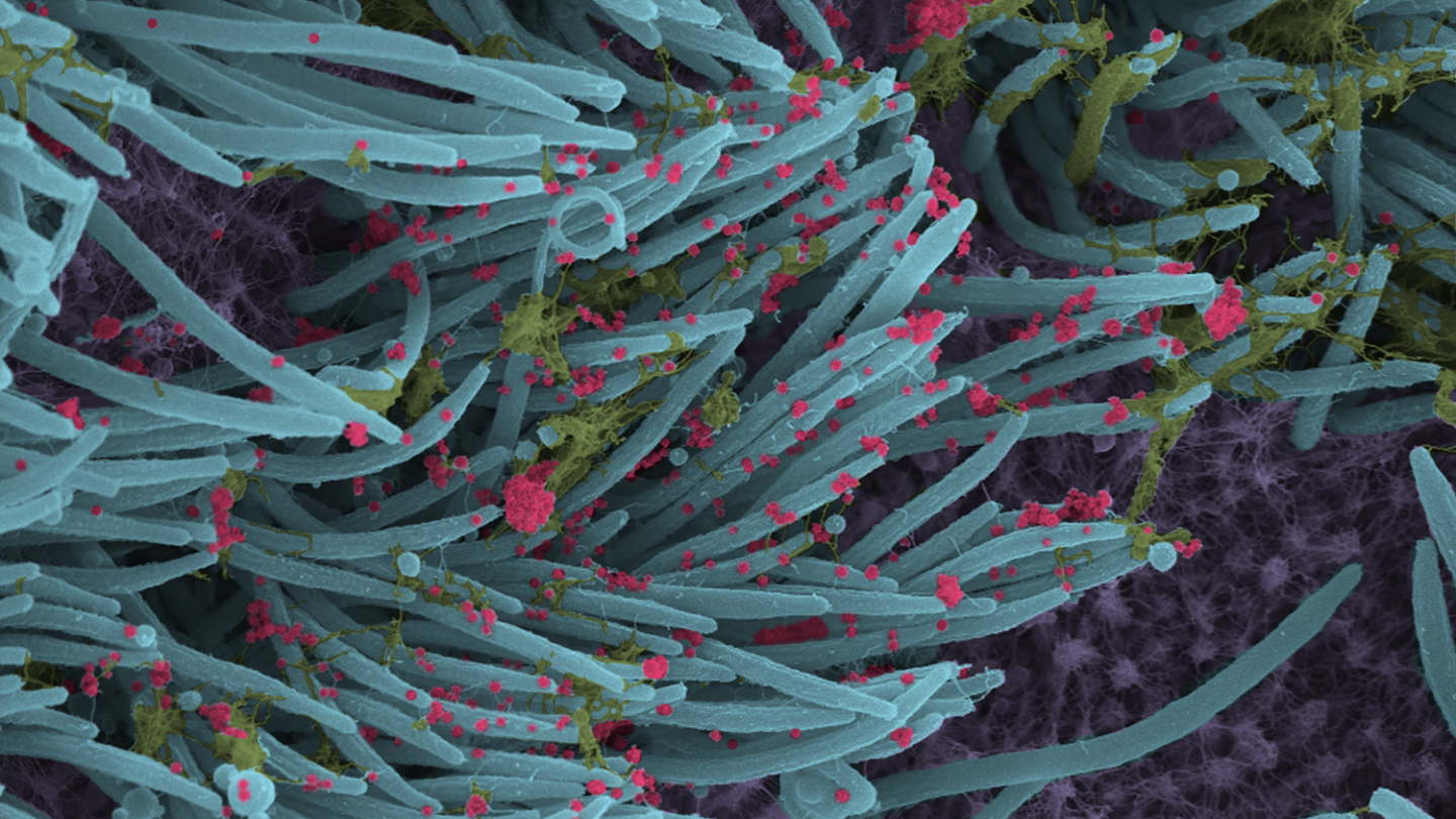 Colored electron microscope image showing blue-gray cilia with scattered pink viral particles and patches of green mucus. Scale bar at bottom left indicates 1 micrometer.