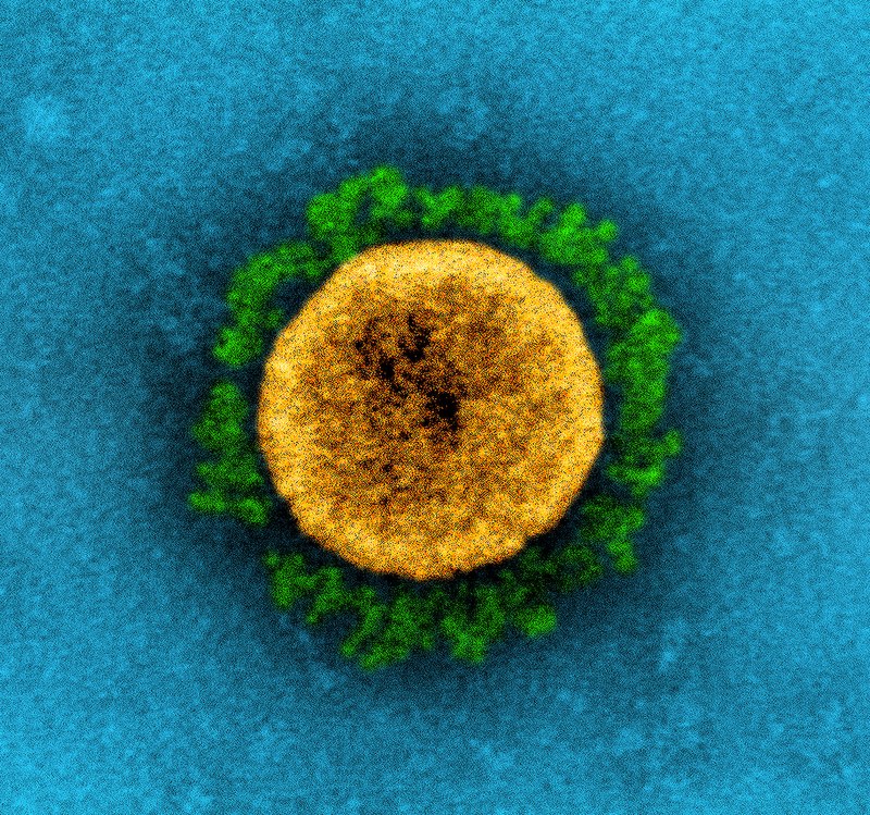 Colorized microscope image of a round, gold virus particle with green spike proteins on a blue background, resembling the structure of the coronavirus.
