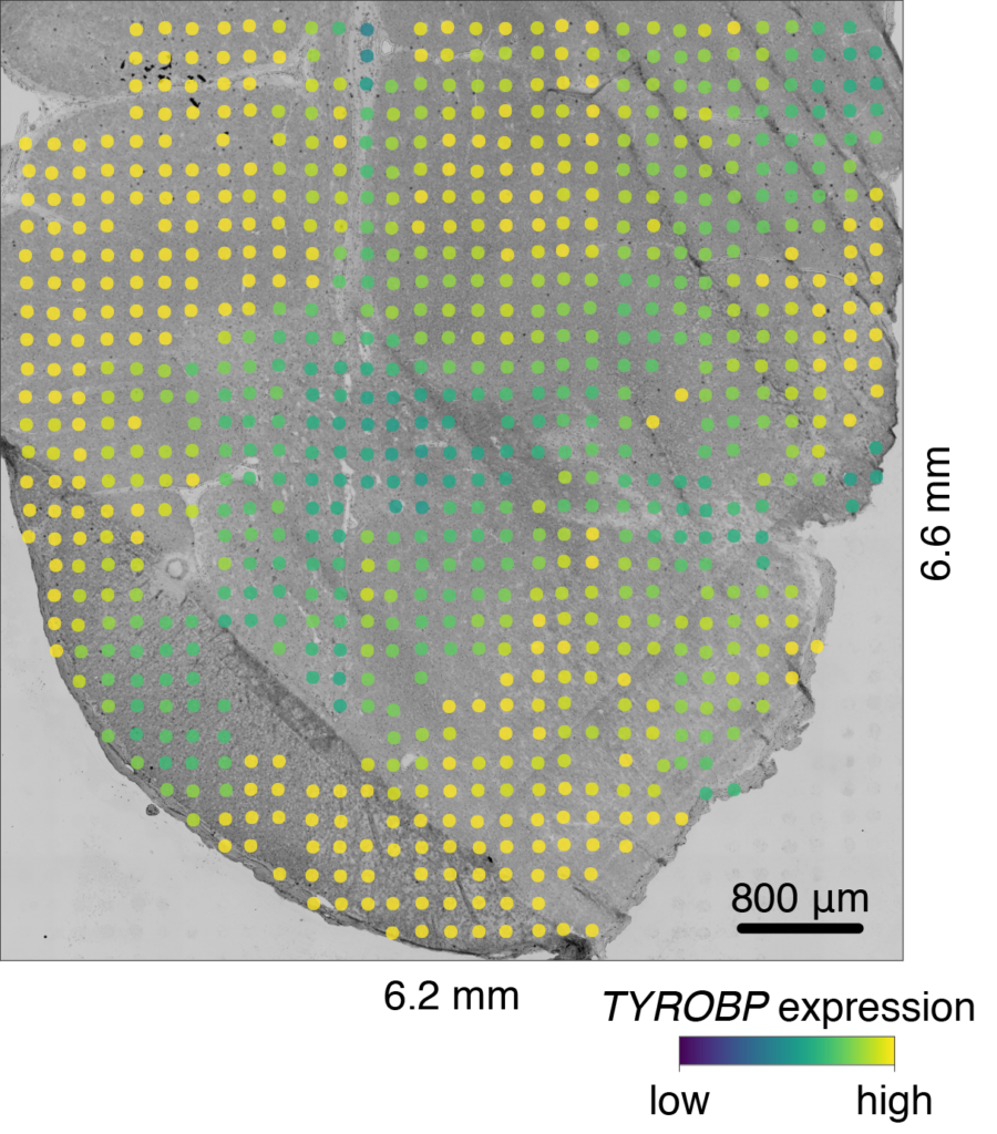 A human spinal tissue sample. On top of the image are a series of colored spots representative of gene expression.