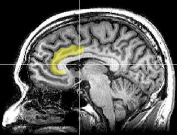 A photograph of an MRI scan of a human brain with the subject's anterior cingulate highlighted in yellow.
