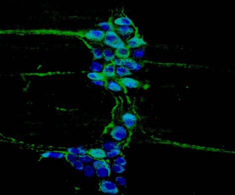 Immunofluorescence image of the enteric neurons in the myenteric plexus of the mouse small intestine. Cell bodies of the neurons are labeled in blue (Anna1) and their dendrites are labeled in green (Map2).
