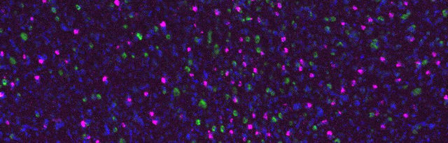 A novel type of excitatory cell (magenta) target inhibitory pallidal cells (green) in Area X of the zebrafinch brain