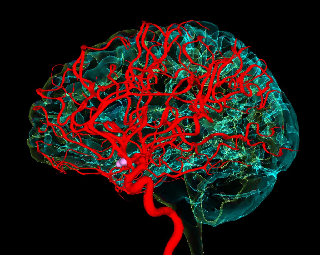 Blood vessels and the brain
