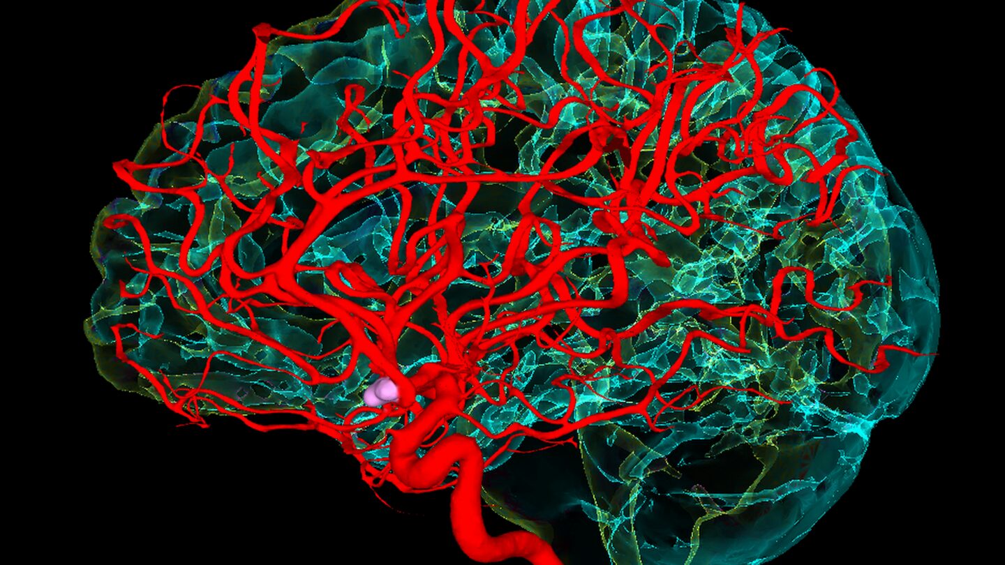 Blood vessels and the brain