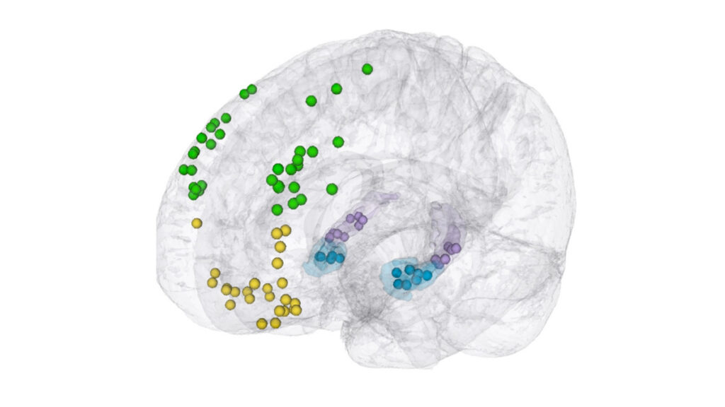 Brain with colorful nodes