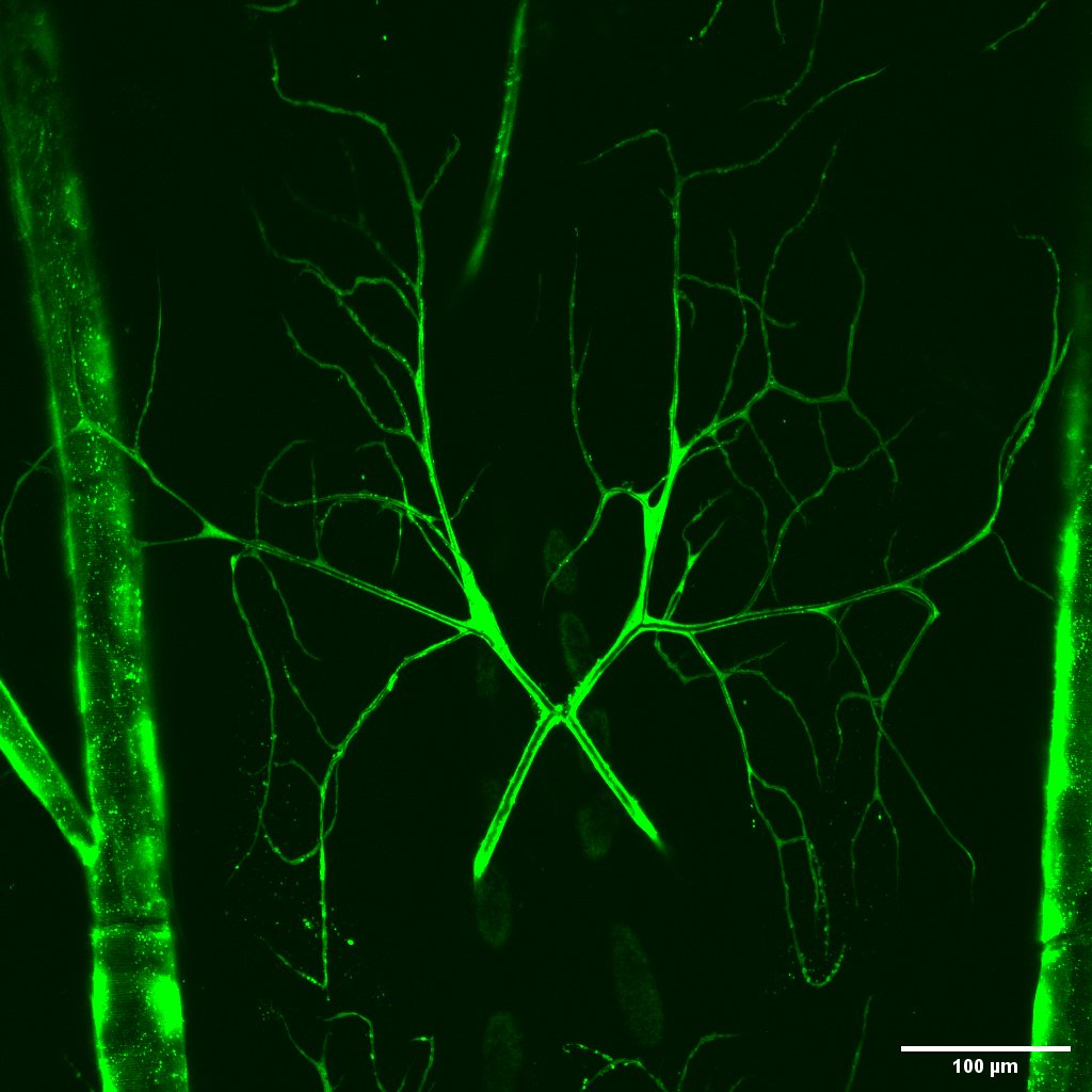 Fluorescent green neurons and branching dendrites are visible against a black background in a microscope image. A scale bar at the bottom right indicates 100 µm.