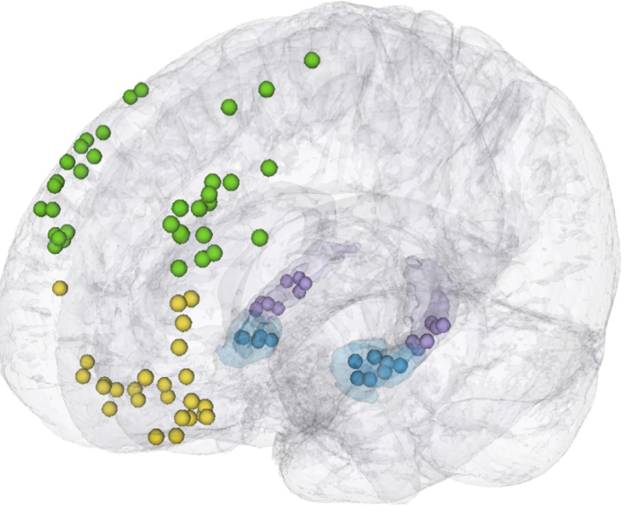 Color-noded brain