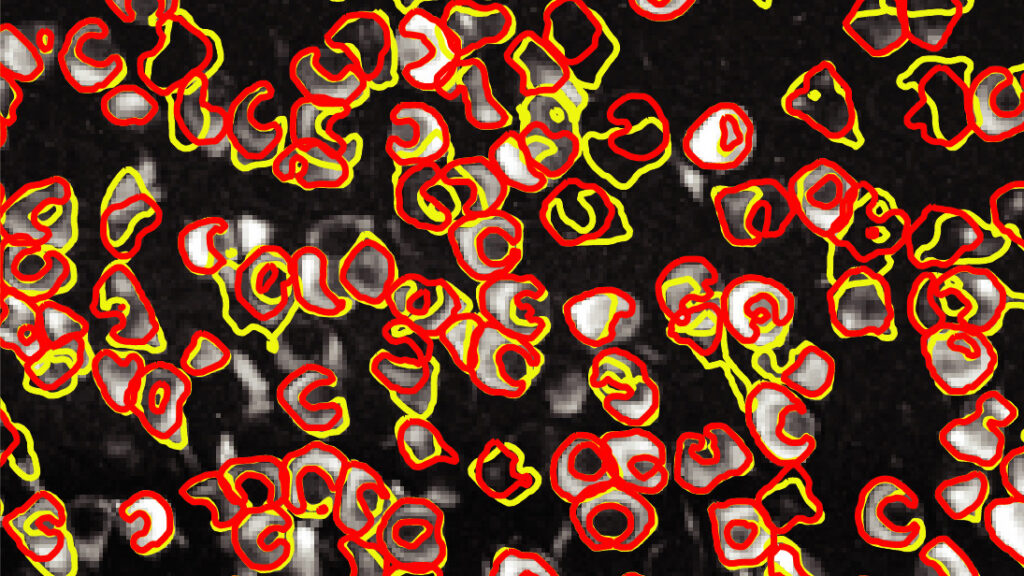 An image of neurons (white) taken using calcium imaging techniques. An innovative software dubbed CaImAn can automatically differentiate between individual neurons (yellow outlines) with nearly the same accuracy as a human (red outlines).