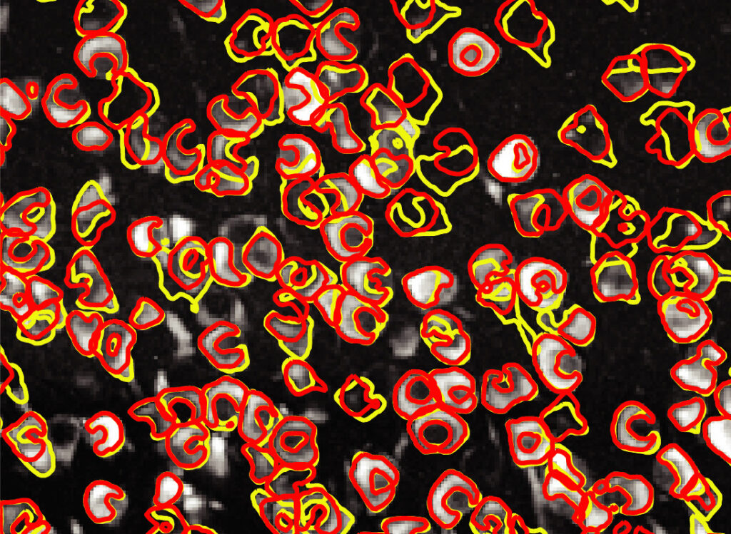 An image of neurons (white) taken using calcium imaging techniques. An innovative software dubbed CaImAn can automatically differentiate between individual neurons (yellow outlines) with nearly the same accuracy as a human (red outlines).
