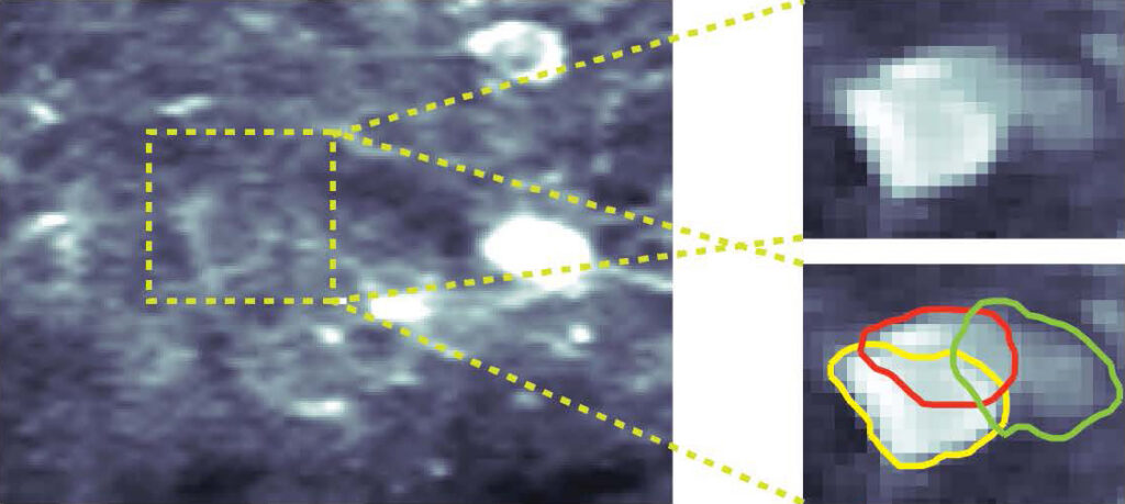 Snapshots of neurons collected using calcium imaging techniques are often difficult to decipher because neurons can overlap. A free software tool called CaImAn can differentiate between individual neurons with near-human accuracy
