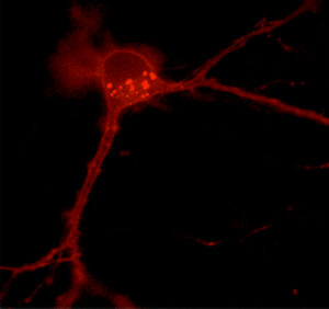 Fluorescent red image of a neuron showing its cell body and branching dendrites against a black background. Bright dots are visible within the cell body.