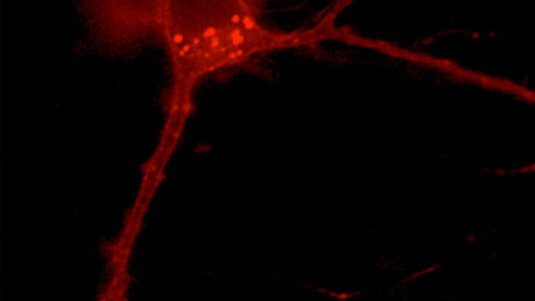 A neuron expressing a red fluorescent voltage sensor
