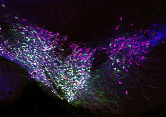 Visualization of the brain
