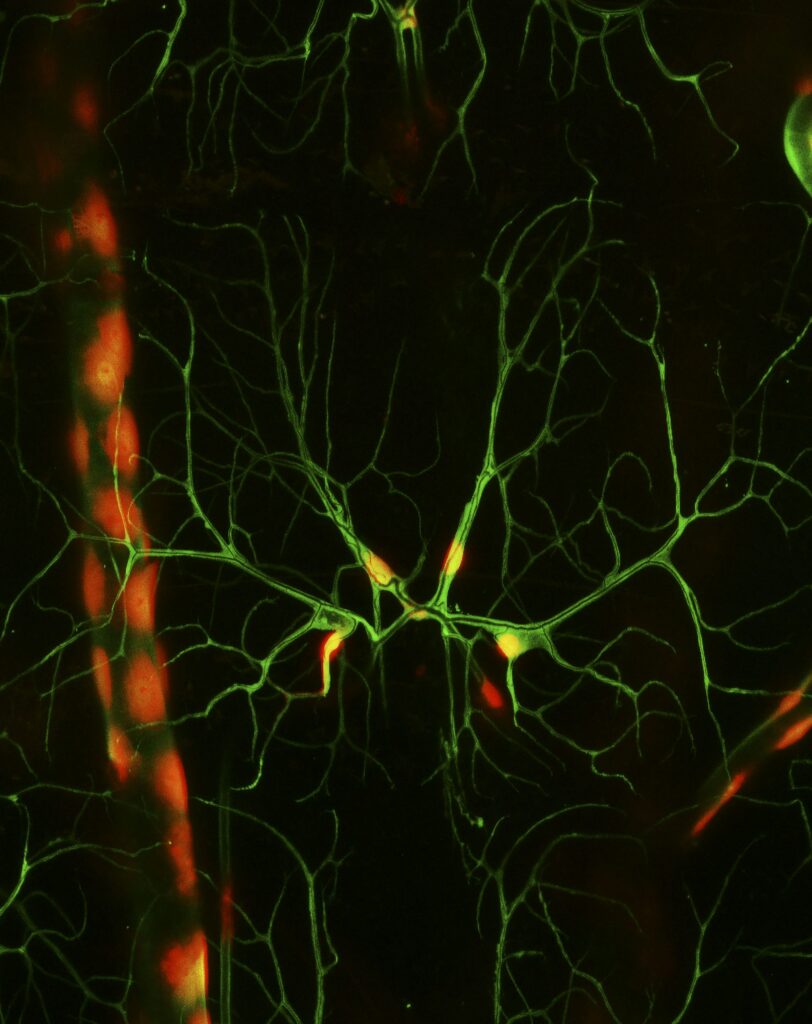Microscopic image showing branching green neural cells with red highlights on a black background, resembling intricate networks or tree branches.