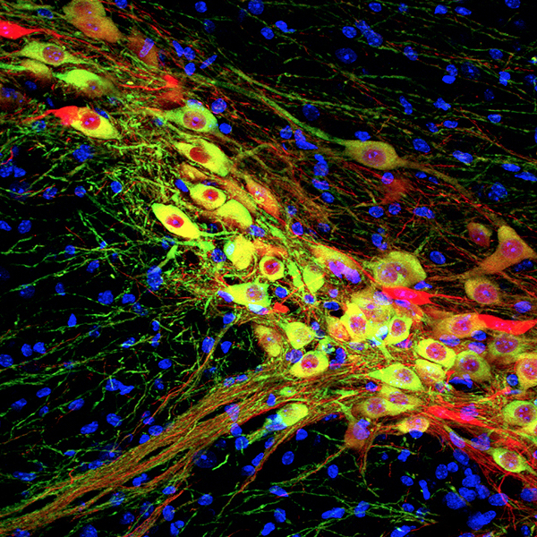 Fluorescent microscopy image of neurons, showing yellow-green cells with red centers and networks, surrounded by blue-stained round nuclei on a black background.