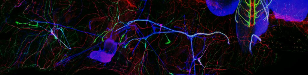 An image of the nervous system of Drosophila fruit fly larvae.