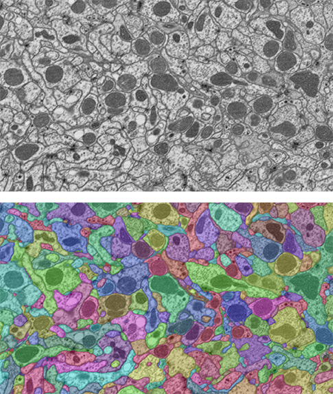 Two images. The top one shows: A close-up snapshot of neurons in the fly brain taken with an electron microscope. The bottom one shows: The same image as above, with colors distinguishing different neurons. An algorithm determines where each neuron starts and ends, and then a team of human proofreaders check the algorithm’s work.