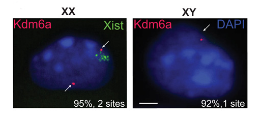 A diagram showing the expression of KDM6A genes in XX and XY chromosomes. In the depiction of the XX chromosome, titled 
