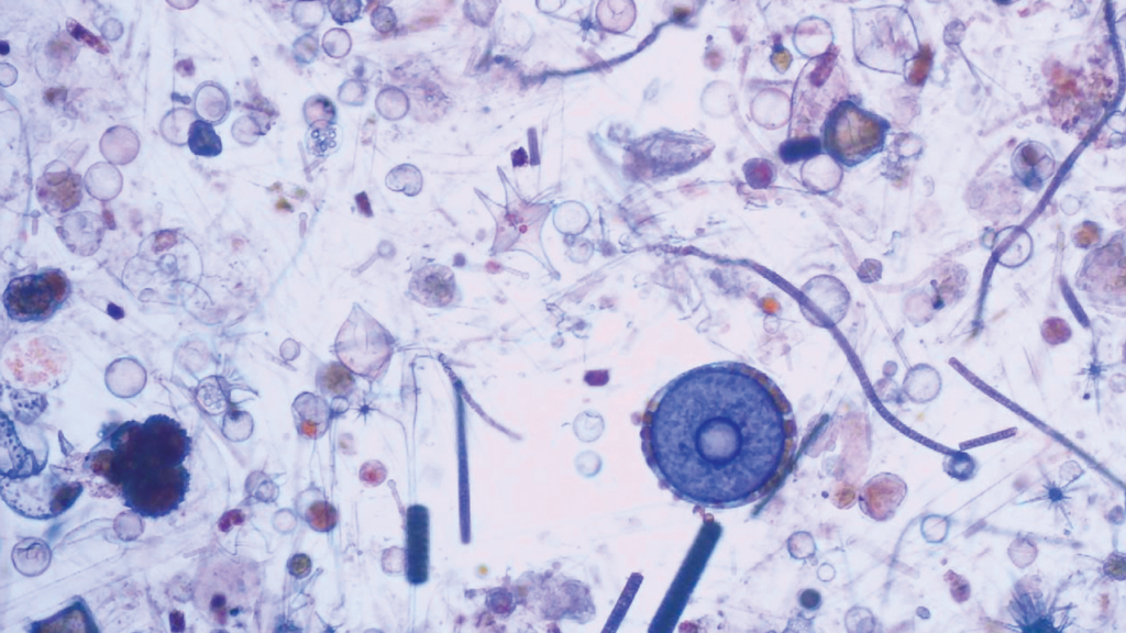 Image of phytoplankton