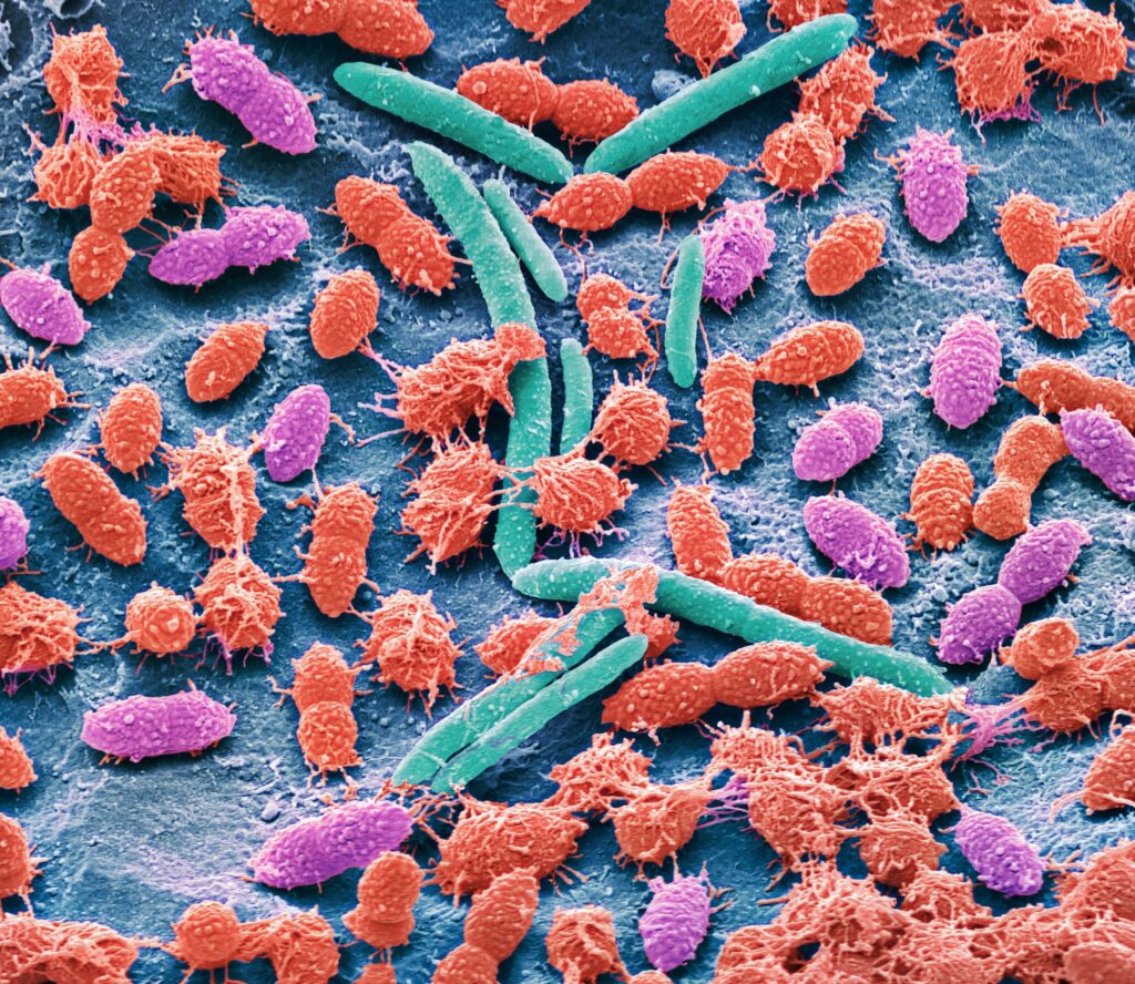 Scanning electron micrograph (SEM) of bacteria cultured from a sample of human faeces. The SEM shows a variety of different bacteria types.