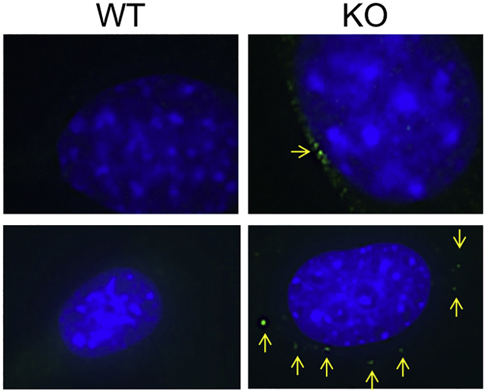 microscopy image comparing cells with and without SIRT6
