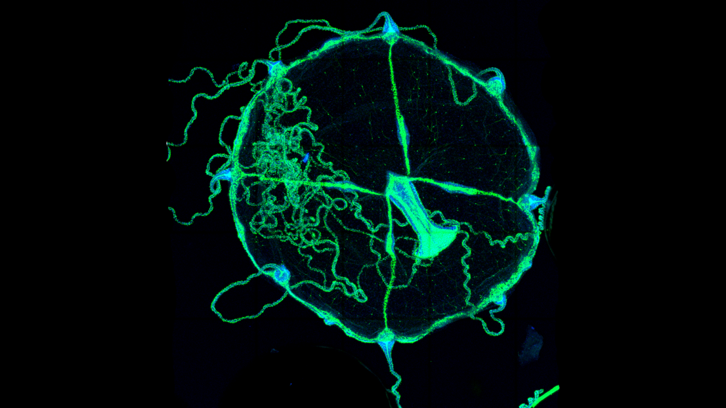 Three images of the jellyfish Clytia with its neurons fluorescing.