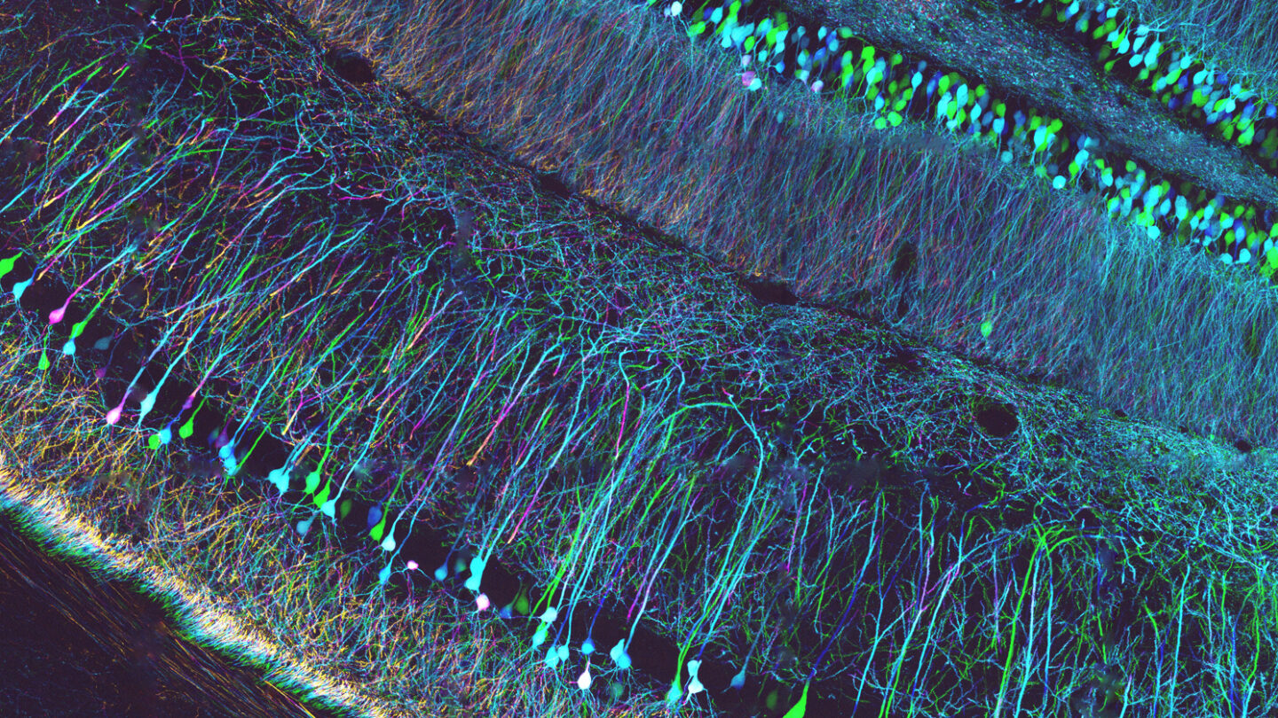 Confocal microscopy of mouse brain