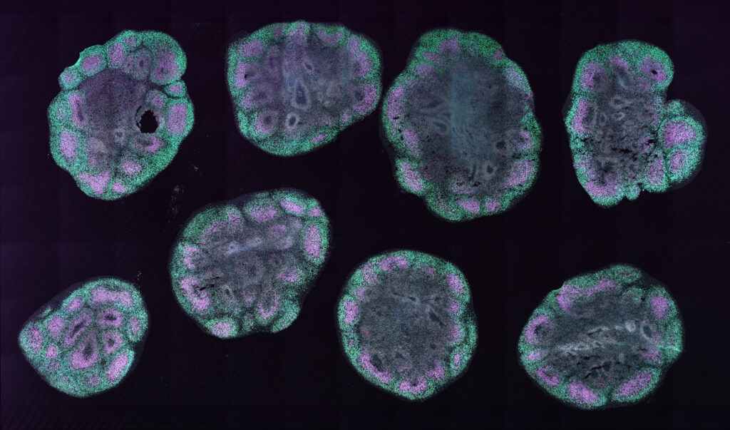 An organoid.