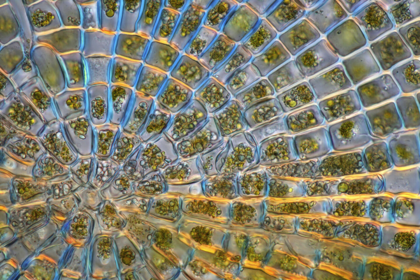 Polarised light micrograph of a Coleochaete sp. green algae colony. Coleochaete algae forms flat, sprawling discs on solid surfaces such as plants or debris in freshwater streams.