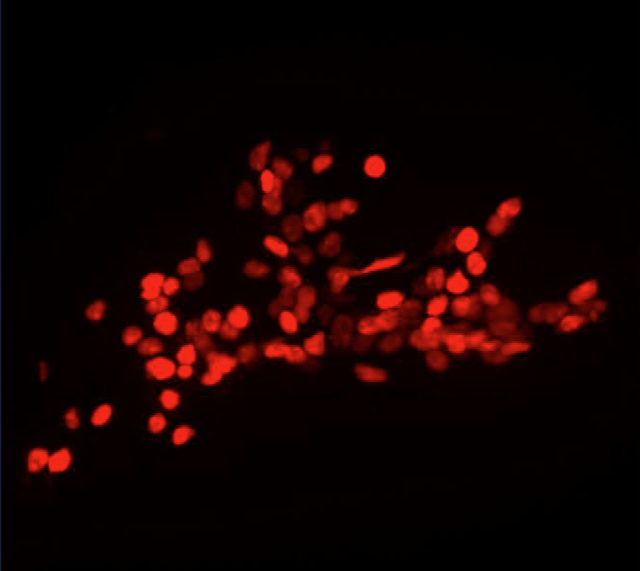 Bright red spots scattered across a black background, resembling glowing cells or particles under a microscope.