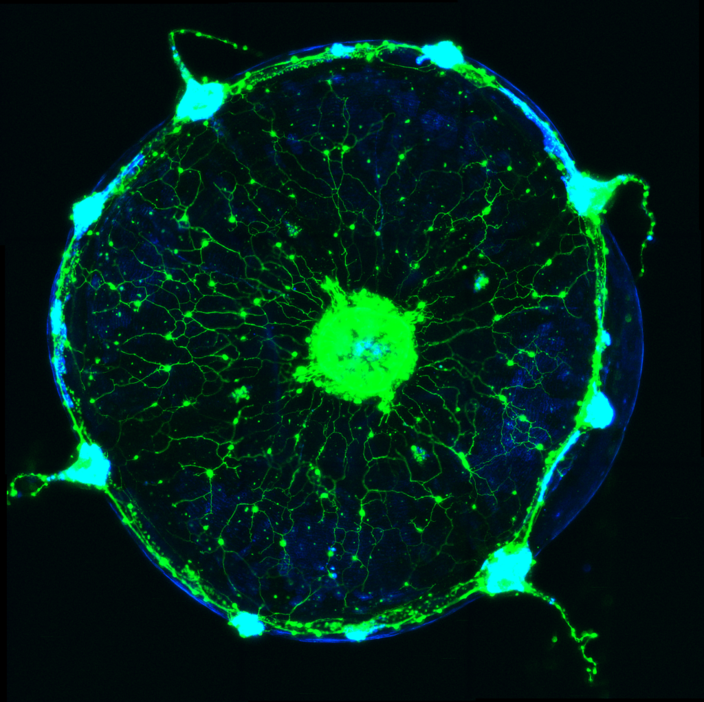 Clytia jellyfish with fluorescent neurons