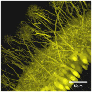 Fluorescent microscopy image showing yellow, hair-like auditory nerve fibers connecting to cells within a section of the inner ear. A 50 μm scale bar is visible in the lower right corner.