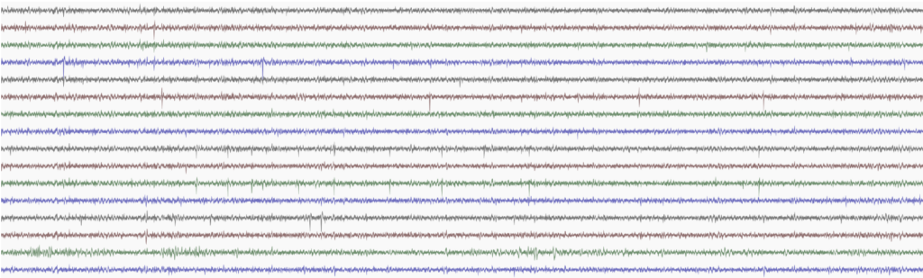 A screenshot of EEG (electroencephalogram) waveforms in multiple horizontal rows, each displaying brainwave activity in different colors: black, red, green, and blue, on a white background.