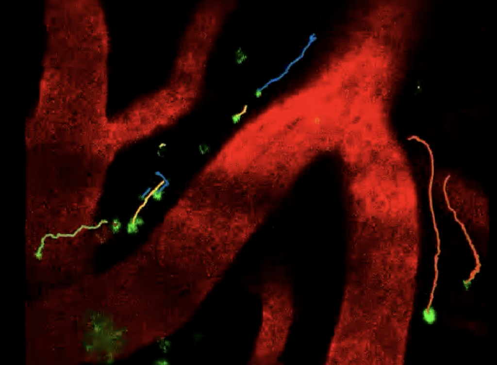 Microspheres showing CSF flow