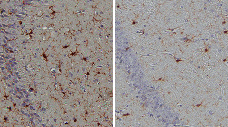 Microglia