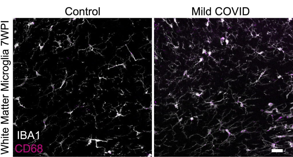 Microscopy image showing signs of microglial activation.
